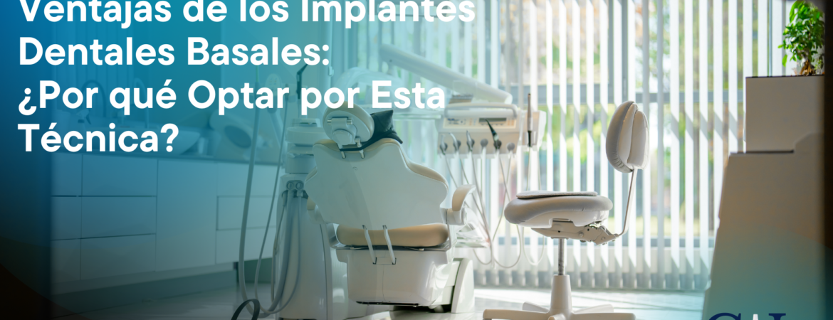 Implantes dentales