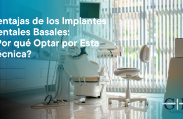 Implantes dentales