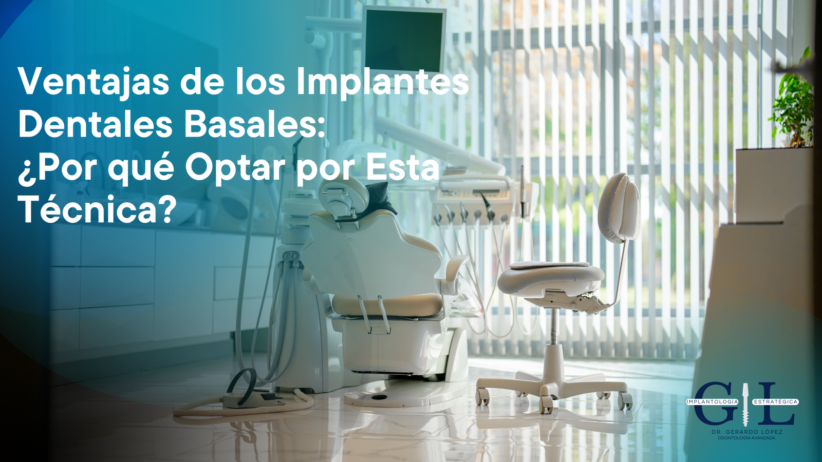 Implantes dentales